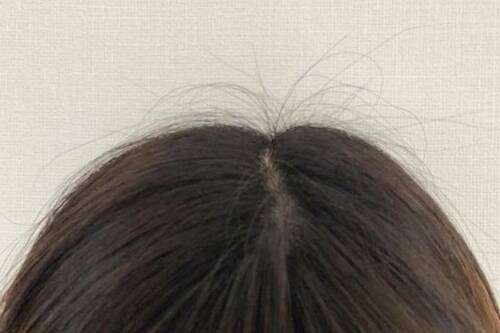 アホ毛が出てしまう原因は?