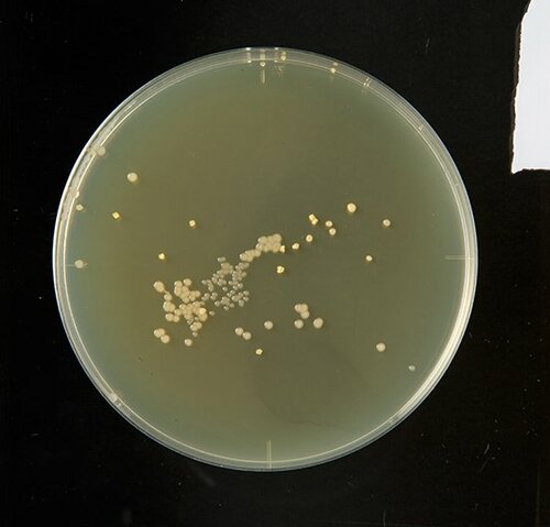 C評価: 【C評価】大腸菌以外効果ナシ 落ちる泡のチカラ手肌プレミアム イメージ