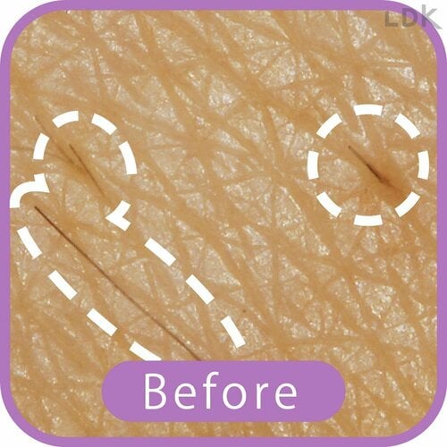 Before VIOシェーバーおすすめ イメージ
