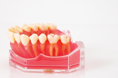 格安なのに高性能! 持ちやすく使い勝手バツグンです 歯ブラシのベストバイをひろゆきがレビューおすすめ イメージ