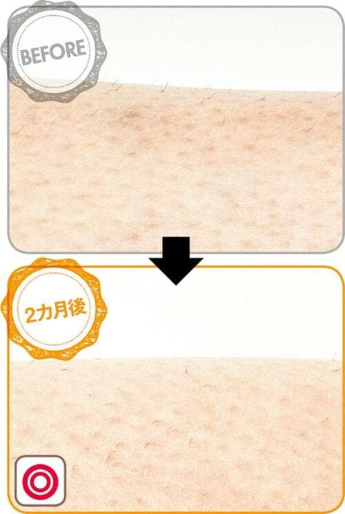 バツグンの効果と使いやすさ!パナソニックがベストを獲得