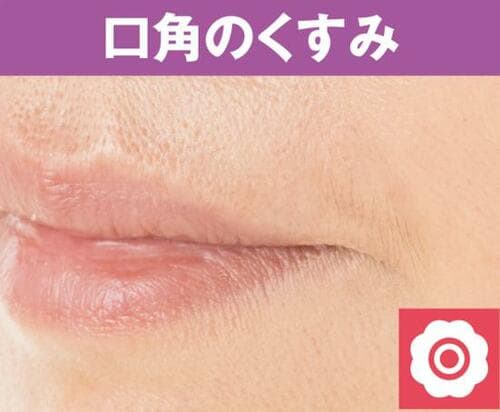 シミのカバー力はさすが!薄く伸ばすのがポイント コンシーラーおすすめ イメージ4
