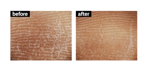 角質ケア ボディスクラブおすすめ イメージ