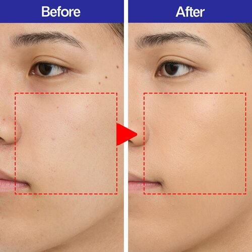 テスト1：カバー力 メンズBBクリームおすすめ イメージ