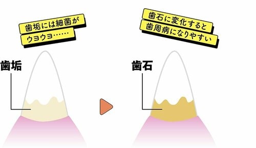 ポイント1:3日に一度は歯をみがく 犬用歯ブラシおすすめ イメージ