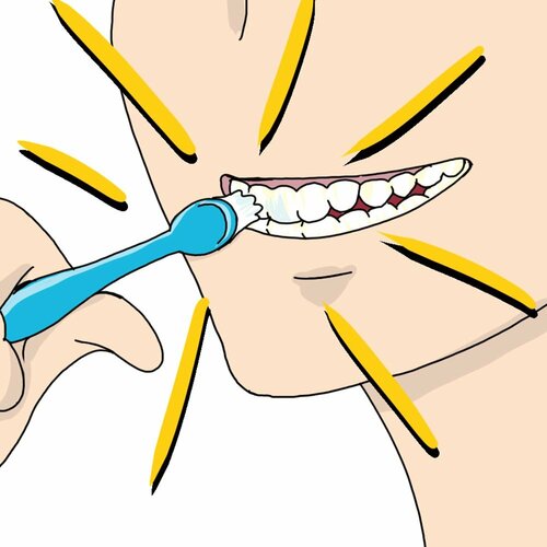 セルフホワイトニング ホワイトニングジェルおすすめ イメージ