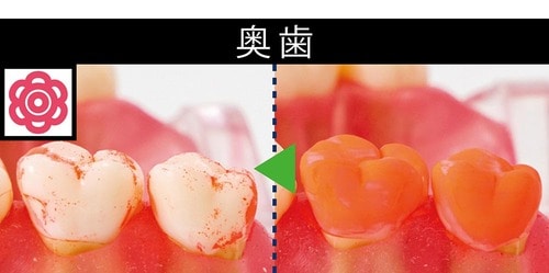 ポイント1:奥歯や歯間の歯垢をやわらか毛先でキャッチ! イメージ2