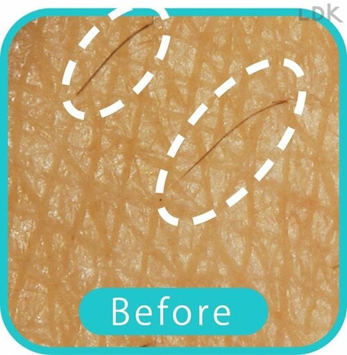 Before 女性用電気シェーバーおすすめ イメージ