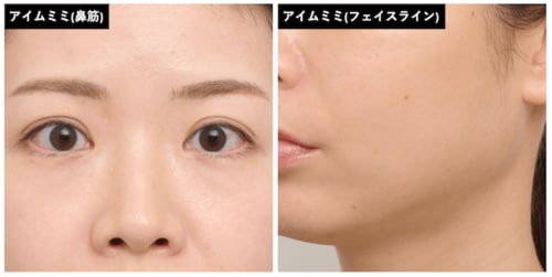 鼻筋に光が通って立体的に シェーディングおすすめ イメージ