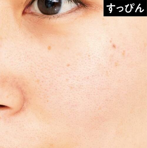 光の効果でとことん毛穴を飛ばすパラドゥ