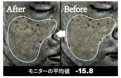 2年連続ベスト!「ETVOS」は肌に優しく効果もあり