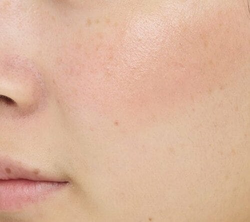 【ツヤ感】グロス系のオイリーなツヤ感 チークおすすめ イメージ