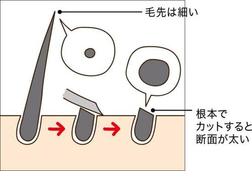 Q3.カミソリを使った自己処理で毛が濃くなるのはなぜ?