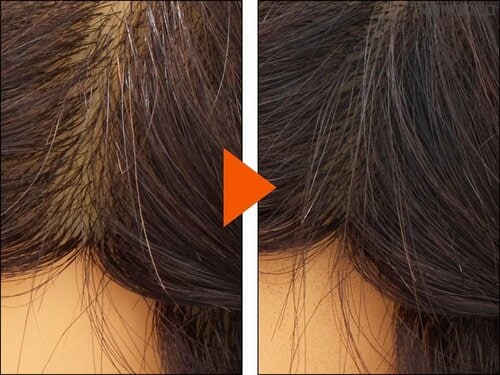 【仕上がり】生え際の薄毛が目立たない! 増毛パウダーおすすめ イメージ