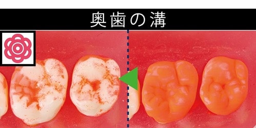 ポイント1:奥歯や歯間の歯垢をやわらか毛先でキャッチ! イメージ3