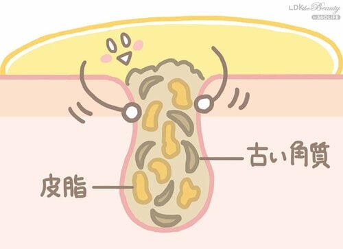 クレンジングが角栓の中の皮脂となじんで落としやすくなる 毛穴クレンジングおすすめ イメージ