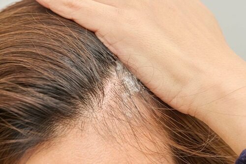 つけやすさ 育毛剤おすすめ イメージ