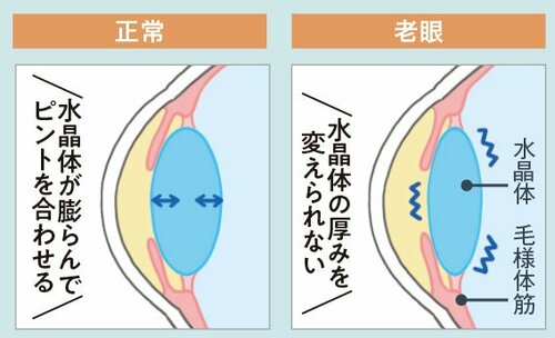 老眼になる仕組みは？ 老眼鏡おすすめ イメージ