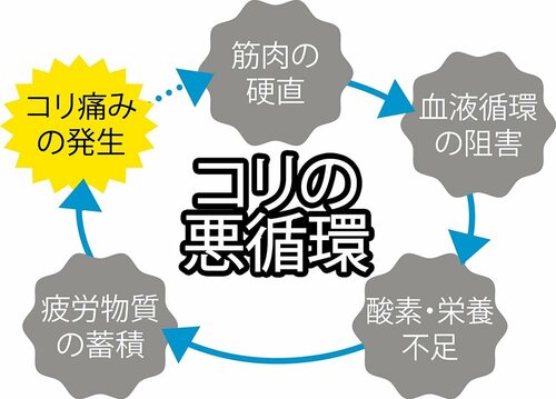 肩こりってそもそも何？ イメージ