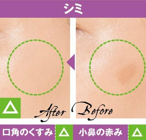 5位: 厚塗り感が出る割にシミを隠しきれない! コンシーラーおすすめ イメージ2
