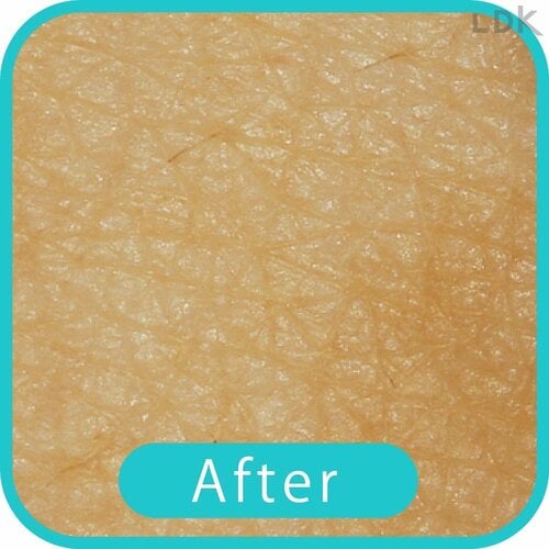 After 女性用電気シェーバーおすすめ イメージ