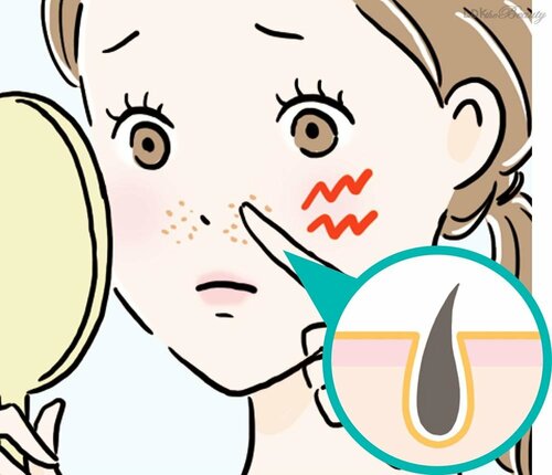 【産毛毛穴】黒くてチクチクしたらコレ！ SNSでバズった毛穴ケアおすすめ イメージ
