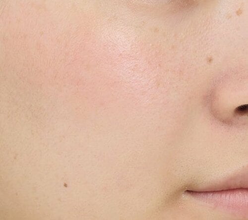 【ツヤ感】年齢を選ばないほどよいツヤ チークおすすめ イメージ