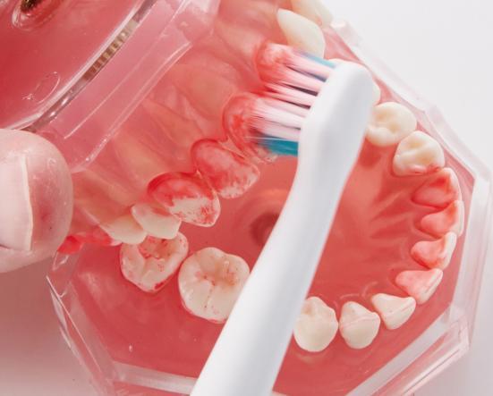 電動歯ブラシの検証