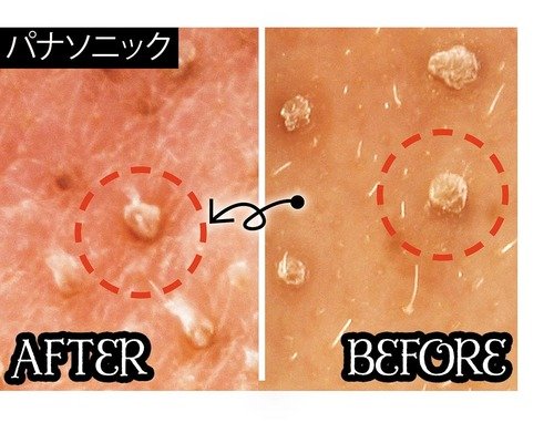 パナソニック「毛穴吸引スポットクリア」 イメージ3