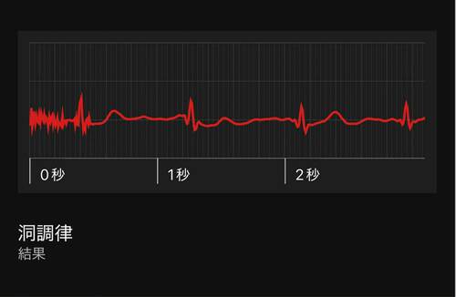 ［健康管理］​心電図 スマートウォッチおすすめ イメージ