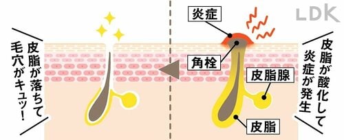 毛穴の奥まで洗えばぶり返す大人ニキビともサヨナラできる プチプラコスメおすすめ イメージ