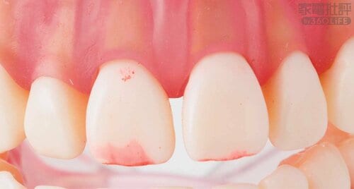 After 安い電動歯ブラシおすすめ イメージ