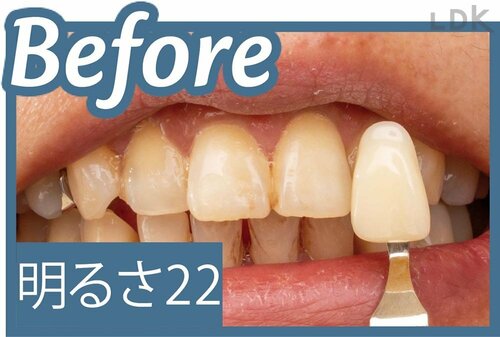 ▼Before イメージ