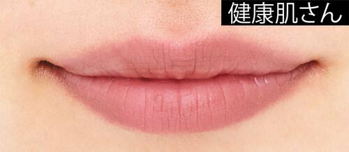 健康肌さん ソフトマットリップおすすめ イメージ