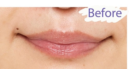 Before/色暗めの唇 ローズリップおすすめ イメージ