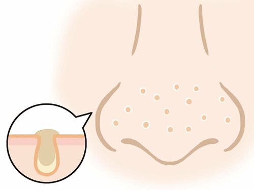 つまり毛穴 毛穴クレンジングおすすめ イメージ