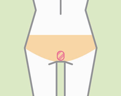 デリケートゾーンってどこ? デリケートゾーンクリームおすすめ イメージ3