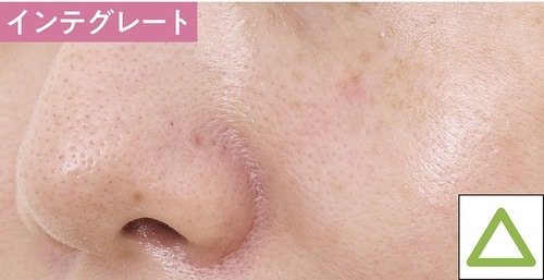 仕上がり 毛穴カバー下地おすすめ イメージ