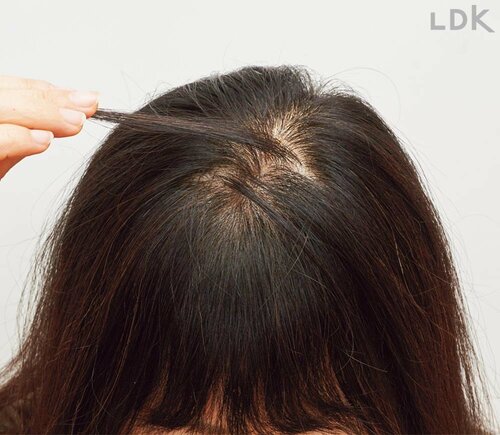 STEP2:右の髪を左に倒しつむじまで交差 生え際隠しおすすめ イメージ