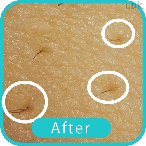 After 女性用電気シェーバーおすすめ イメージ