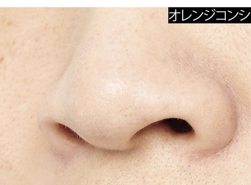 黒ずみ毛穴はオレンジで隠す! イメージ3