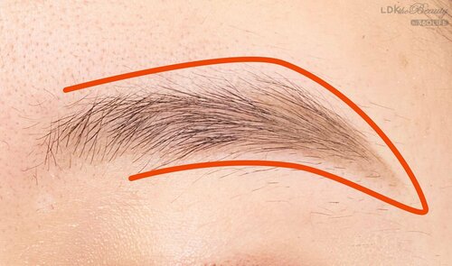 2：1mm以内の毛は残して処理 イメージ