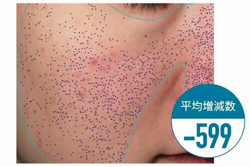 毛穴目立ちが圧倒的に減少! イメージ