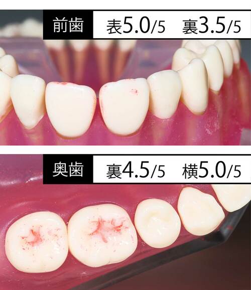 歯磨き後 家電批評ベストバイオブザイヤーおすすめ イメージ