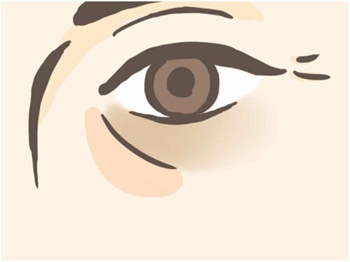 1:クマのシワの下側に塗る メンズコンシーラーおすすめ イメージ