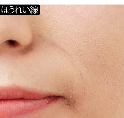 ほうれい線：重ねるほどシワに入り込む イメージ