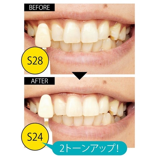 判定:即買い! たった1週間で2トーンアップ「ちゅらトゥース ホワイトニング」 イメージ2