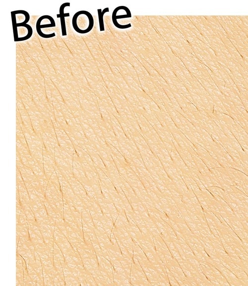 ▼Before L字カミソリおすすめ イメージ