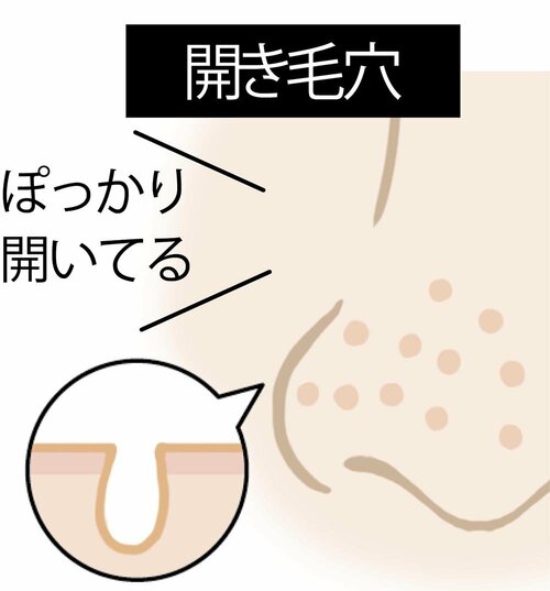 毛穴目立ちの原因や毛穴タイプの例 イメージ3