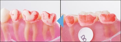 汚れ落ち イメージ